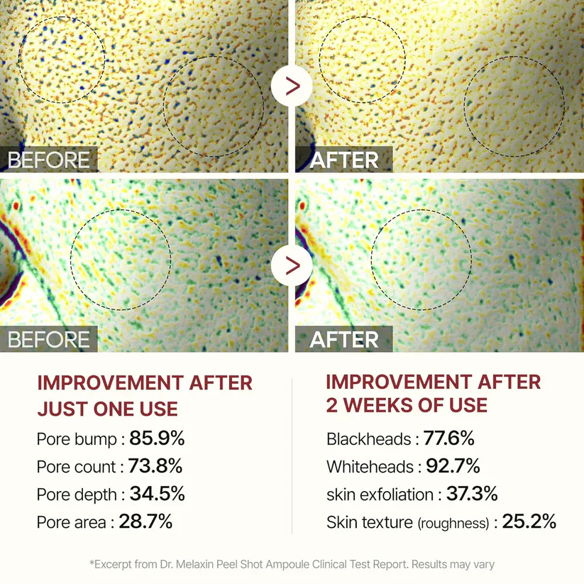 Selie™ Radiant Rice Peel Ampoule